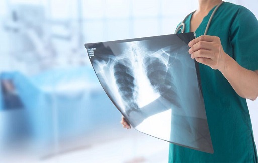 X-Ray Scan